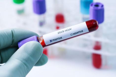Tot ce trebuie să știi despre testul pentru depistarea coronavirusului. După cât timp vin rezultatele și ce șanse de eroare există?
