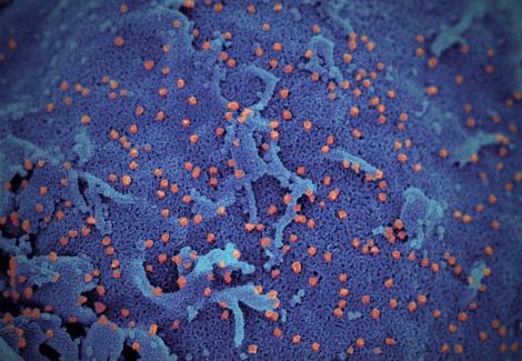 Marea Britanie trece la a doua din patru etape ale unui plan de combatere a epidemiei de coronavirus, pe fondul creşterii numărului de cazuri