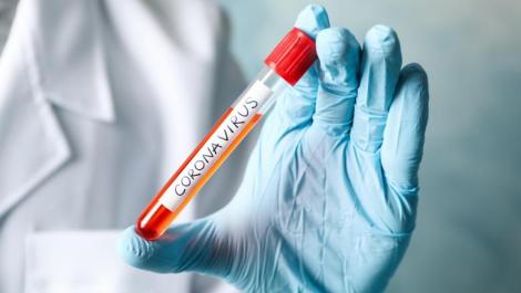 Autoritățile par depășite! Testele pentru coronavirus, aproape de epuizare, după ce numărul de cazuri a crescut în toata lumea