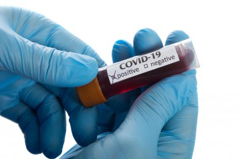 4.500 de dolari, bani în mână, pentru oricine este dispus să fie infectat cu coronavirus. Nu e glumă! Ce condiții trebuie îndeplinite