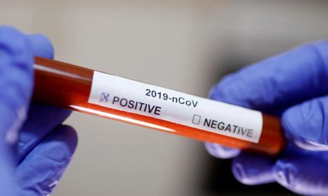 Coronavirus în România, 22 mai 2020. Încă şapte persoane infectate cu noul coronavirus au murit, numărul total al celor decedaţi ajungând la 1.166
