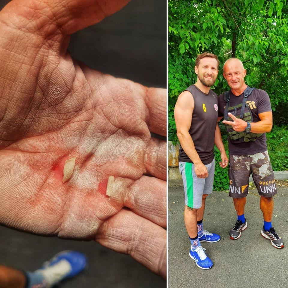 Dani Oțil  și-a șocat fanii! Are palmele pline de răni și bășici! Ce a pățit prezentatorul de la Neatza!