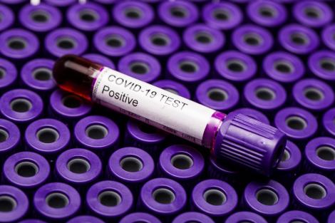 Veste excelentă! A apărut testul ce îți spune dacă ai fost infectat cu noul coronavirus: „Garantat, 100%! Nu există rezultate false!”