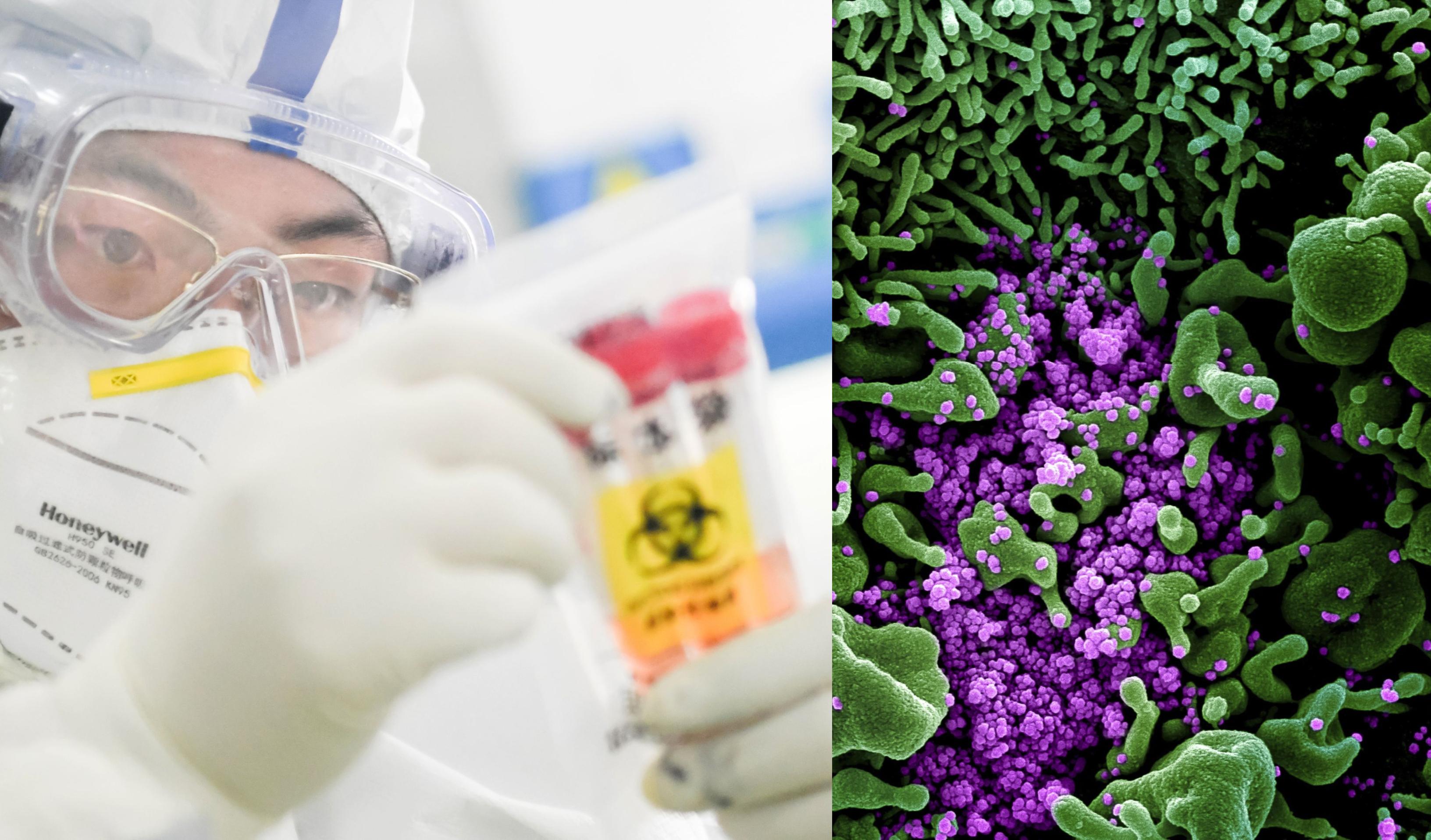 Restricțiile pentru protejarea sănătații sunt posibile &icirc;ncă doi ani! Avertismentul unui epidemiolog: "Avem cunoştinţe prea puţine despre acest virus. Este posibil să descoperim calităţi neplăcute!"