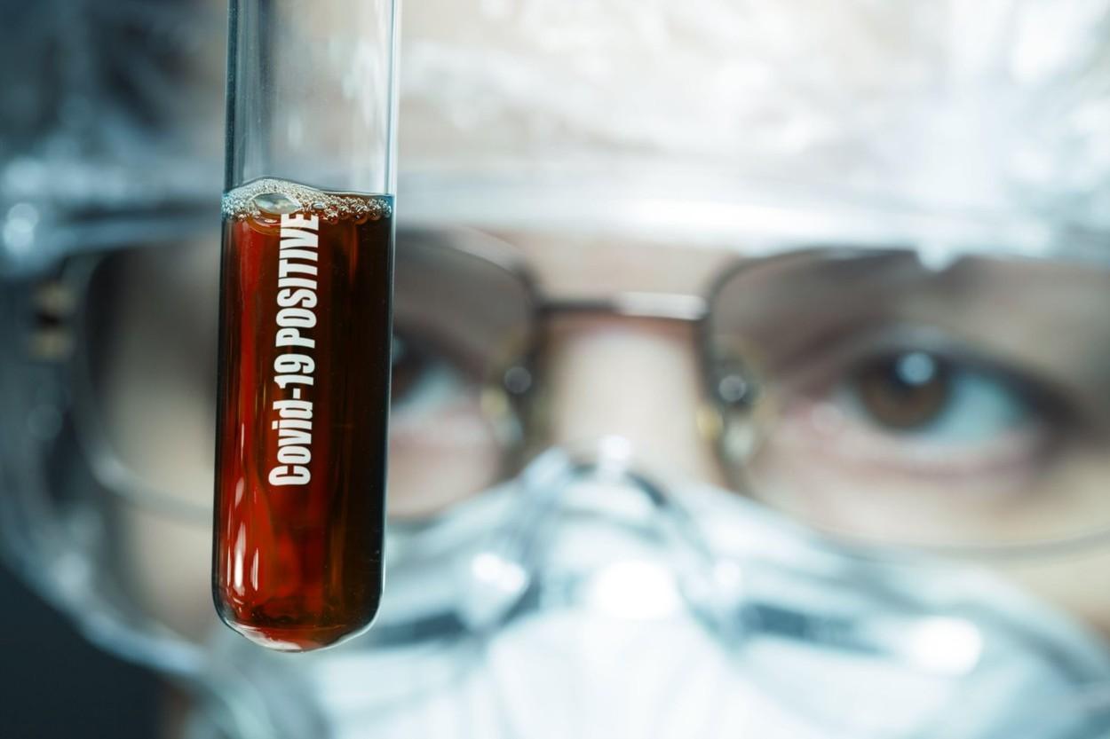 &bdquo;Tulpina de coronavirus apărută &icirc;n Europa este mult mai contagioasă dec&acirc;t cea din China!&rdquo;. Avertisment de la cercetători! Ce se poate &icirc;nt&acirc;mpla, la vară