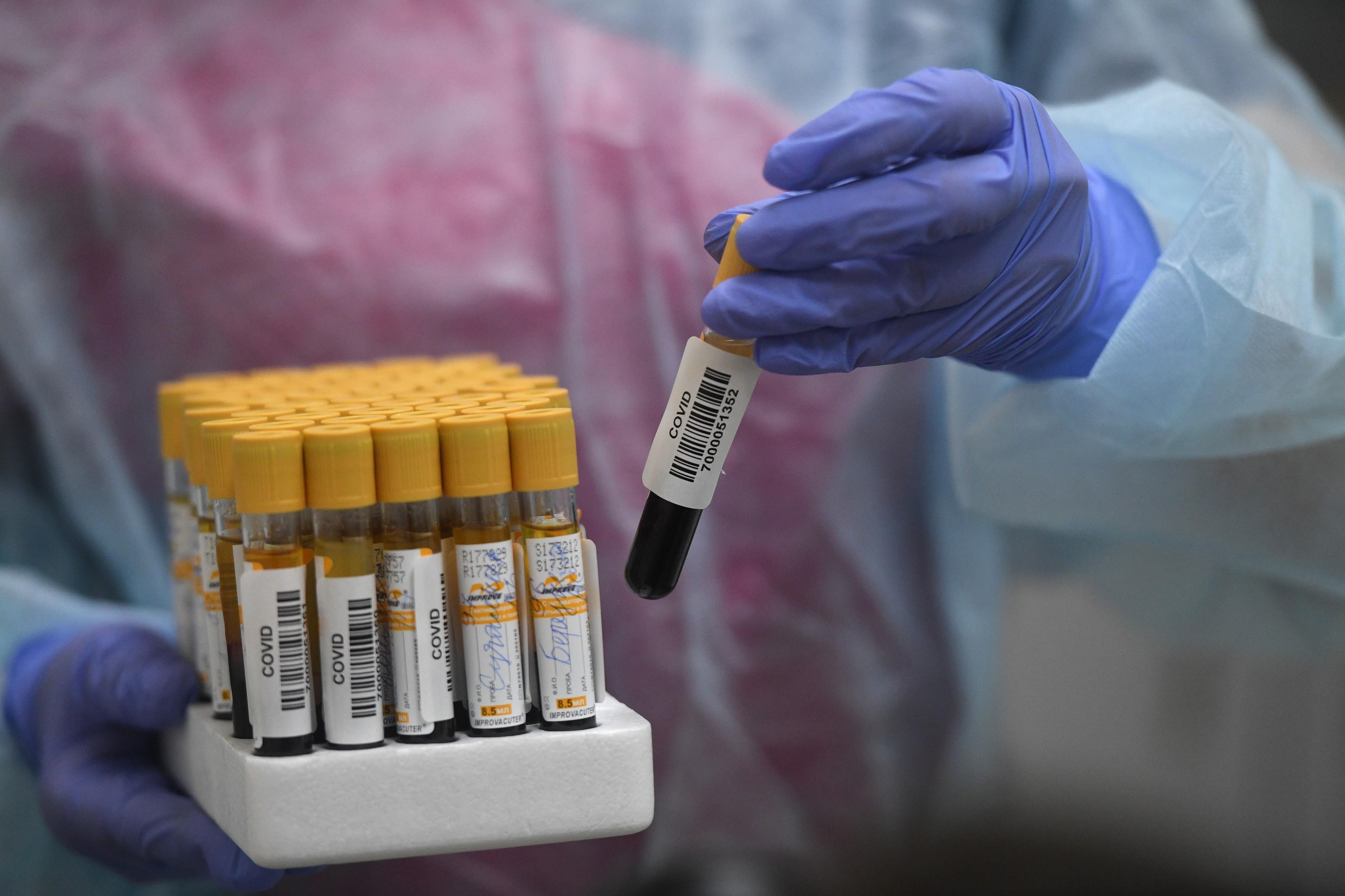 Coronavirus &icirc;n Rom&acirc;nia, 1 iunie 2020. Live Update. Noi decese &icirc;n r&acirc;ndul pacienților cu COVID-19! La c&acirc;t a crescut bilanțul morților!