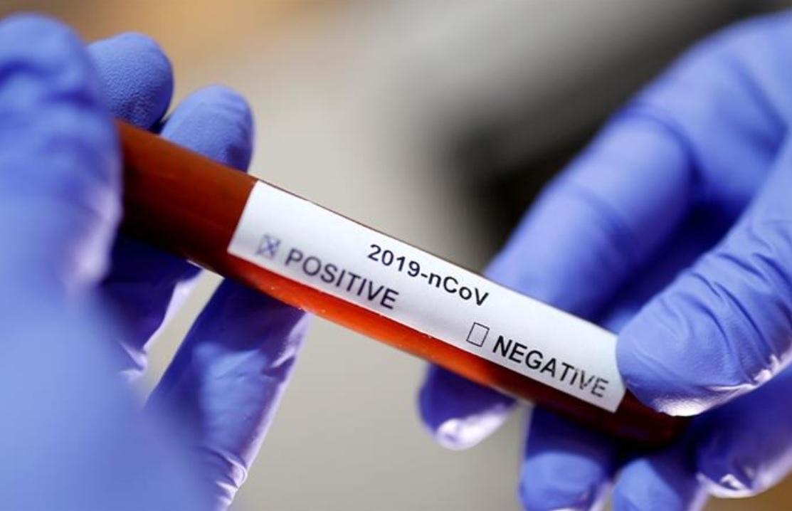 Numărul real de cazuri de coronavirus din Rom&acirc;nia, de 10-20 de ori mai mare. Cum poți să afli dacă ai fost sau nu infectat cu COVID-19