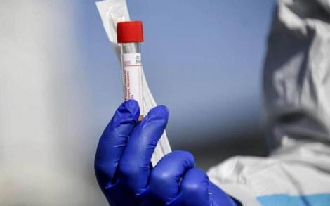 Buzău: Trusele de testare pentru coronavirus s-au epuizat. Probele sunt din nou trimise la Institutul Cantacuzino din Bucureşti pentru analiză