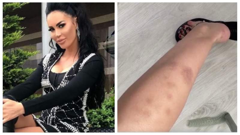 Ispita Bianca Pop de la Insula iubirii a fost bătută
