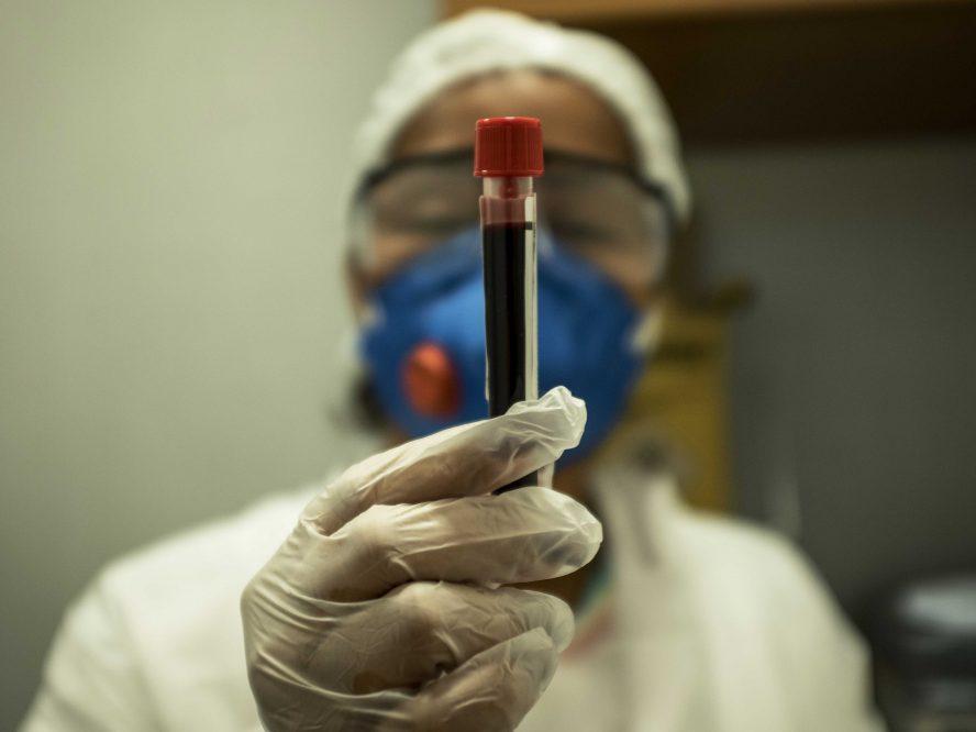 Aproape 600 de cazuri de coronavirus, &icirc;n ultimele 24 de ore. Rom&acirc;nia a depășit 31.000 de &icirc;mbolnăviri cu COVID-19