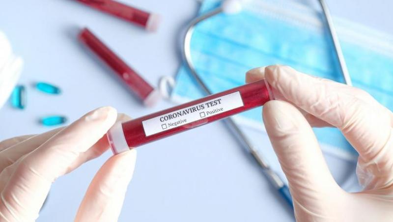 Grupul de Comunicare Strategică (GCS) a prezentat noile cifre ale epidemiei de coronavirus din România, pentru data de 26 iulie 2020