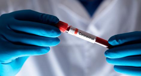 Ultimă oră! Explozie de cazuri noi de coronavirus în România. A doua zi consecutivă cu peste 400 de îmbolnăviri