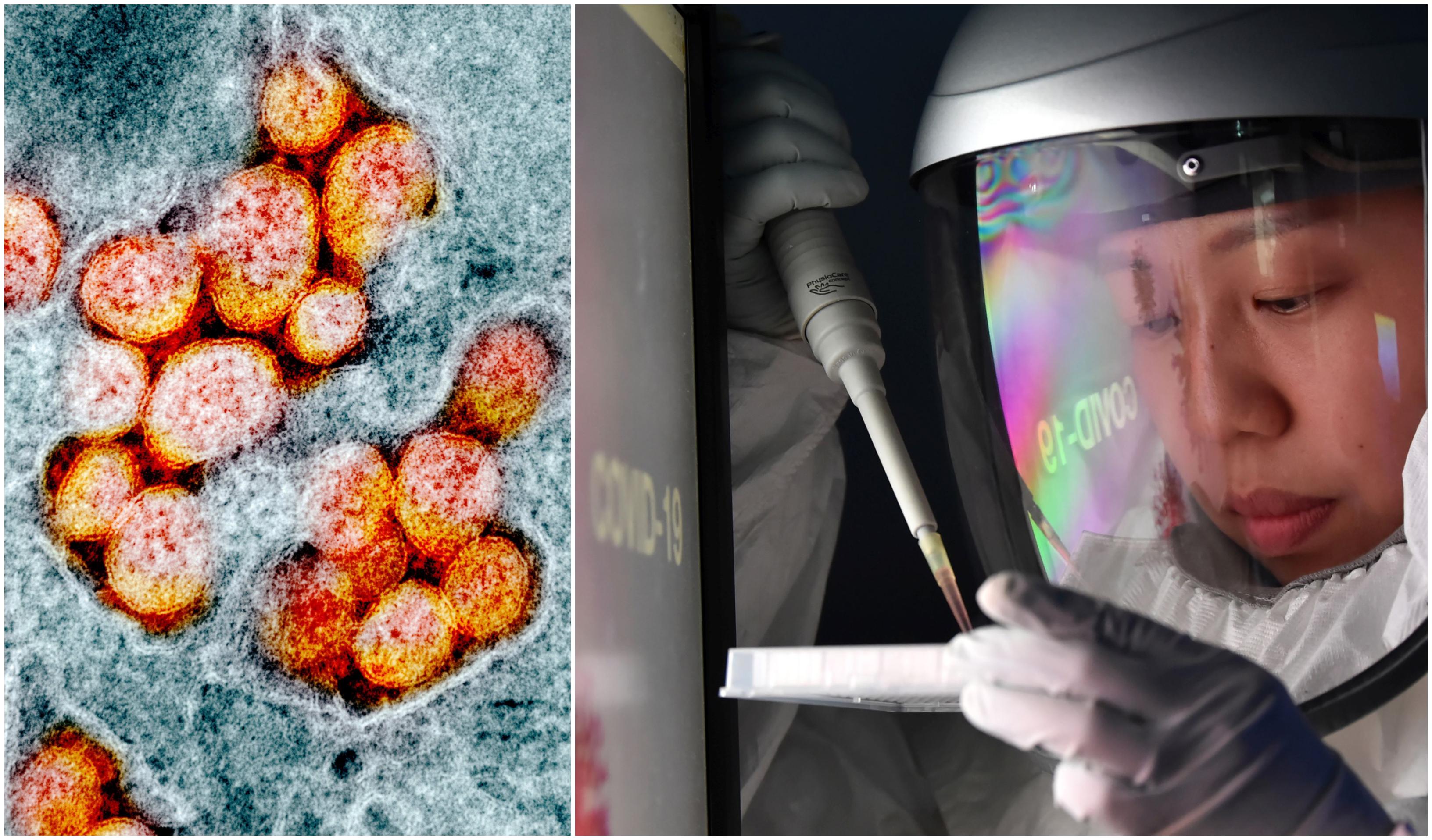 Alertă! Noua tulpină a coronavirusului este D614G și acționează mai puternic. Ce se &icirc;nt&acirc;mplă &icirc;n corpul pacienților