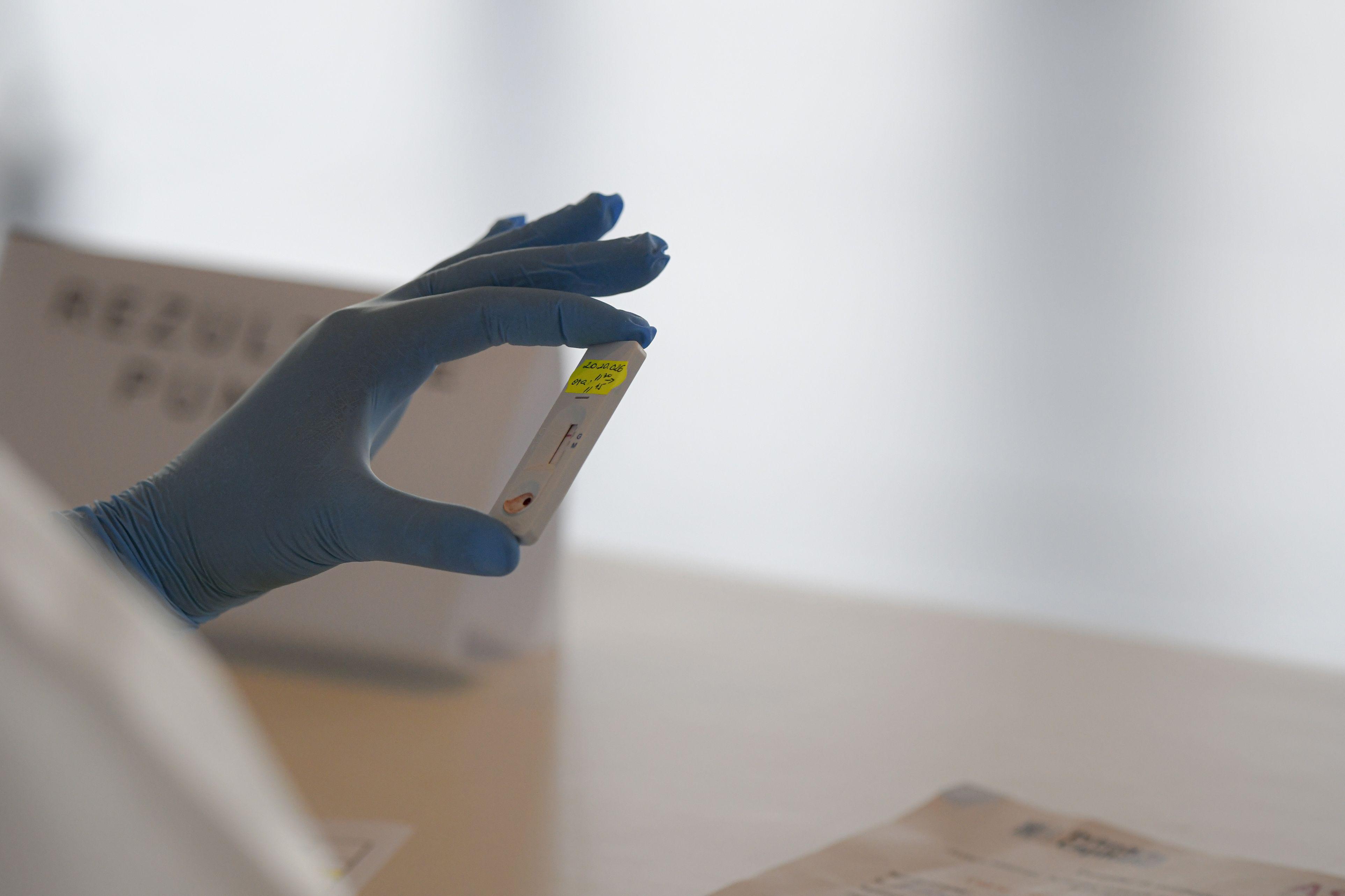 Coronavirus &icirc;n Rom&acirc;nia, 6 iulie 2020, Live Update. 250 de cazuri noi raportate de autorități. Numărul total se apropie de 30.000