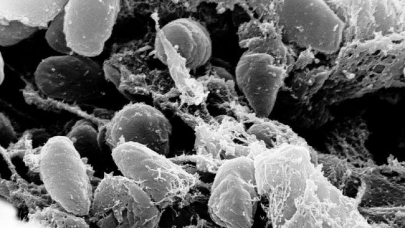 Ciuma bubonică: Principalele modalități de transmitere,simptome și tratament