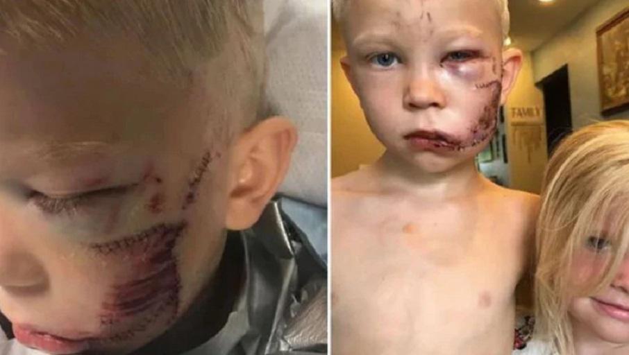 &bdquo;Dacă cineva trebuia să moară, eu eram acela&rdquo;. Erou la șase ani, după ce și-a salvat sora din colții c&acirc;inelui! A fost desemnat cel mai curajos om de pe planetă