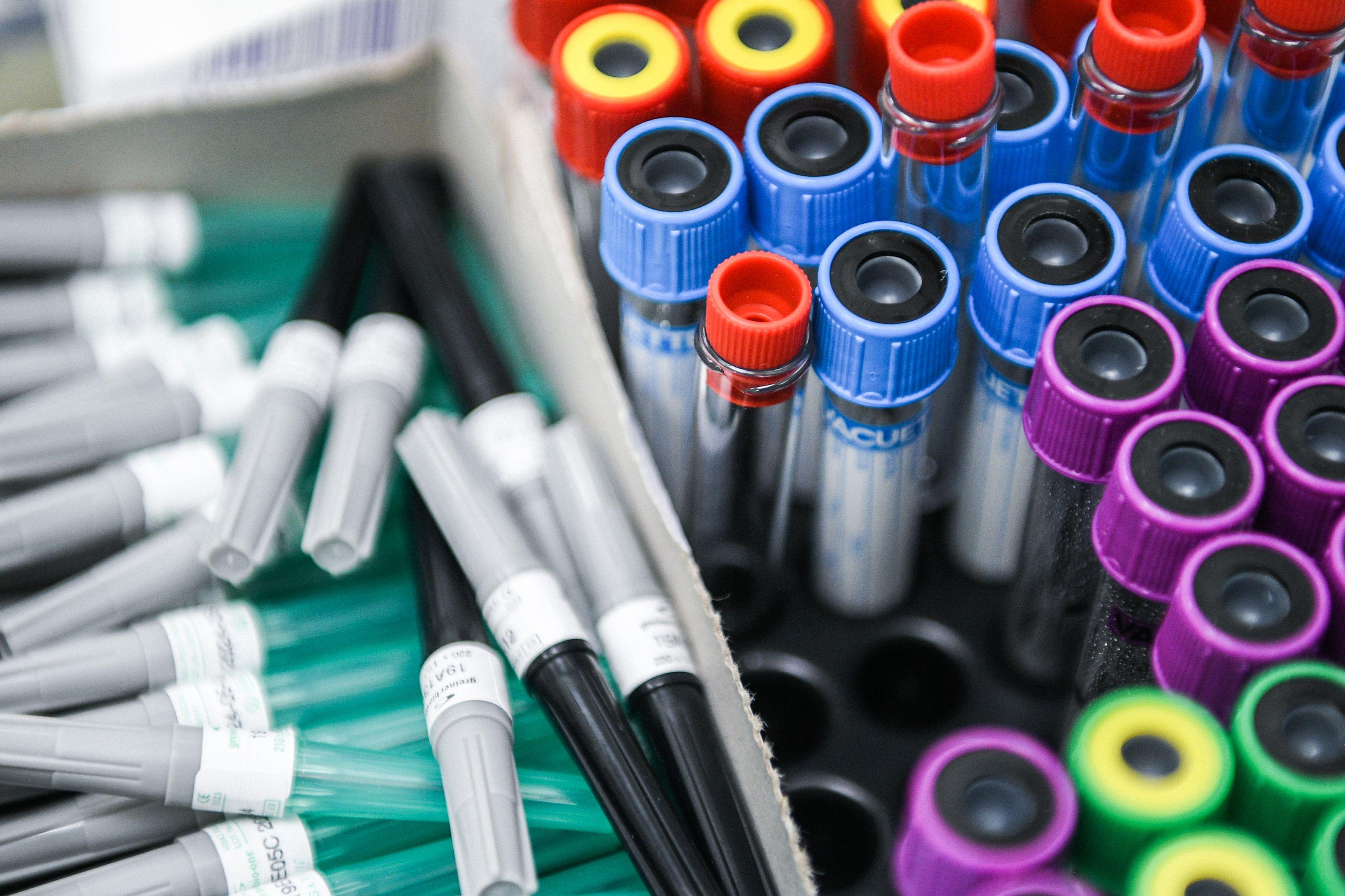 Crește din nou numărul cazurilor de coronavirus din Rom&acirc;nia. Sunt peste 76.000 de persoane infectate, iar numărul bolnavilor de la ATI se apropie de 500