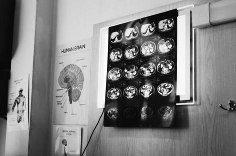 Cand se impune realizarea unui CT cerebral