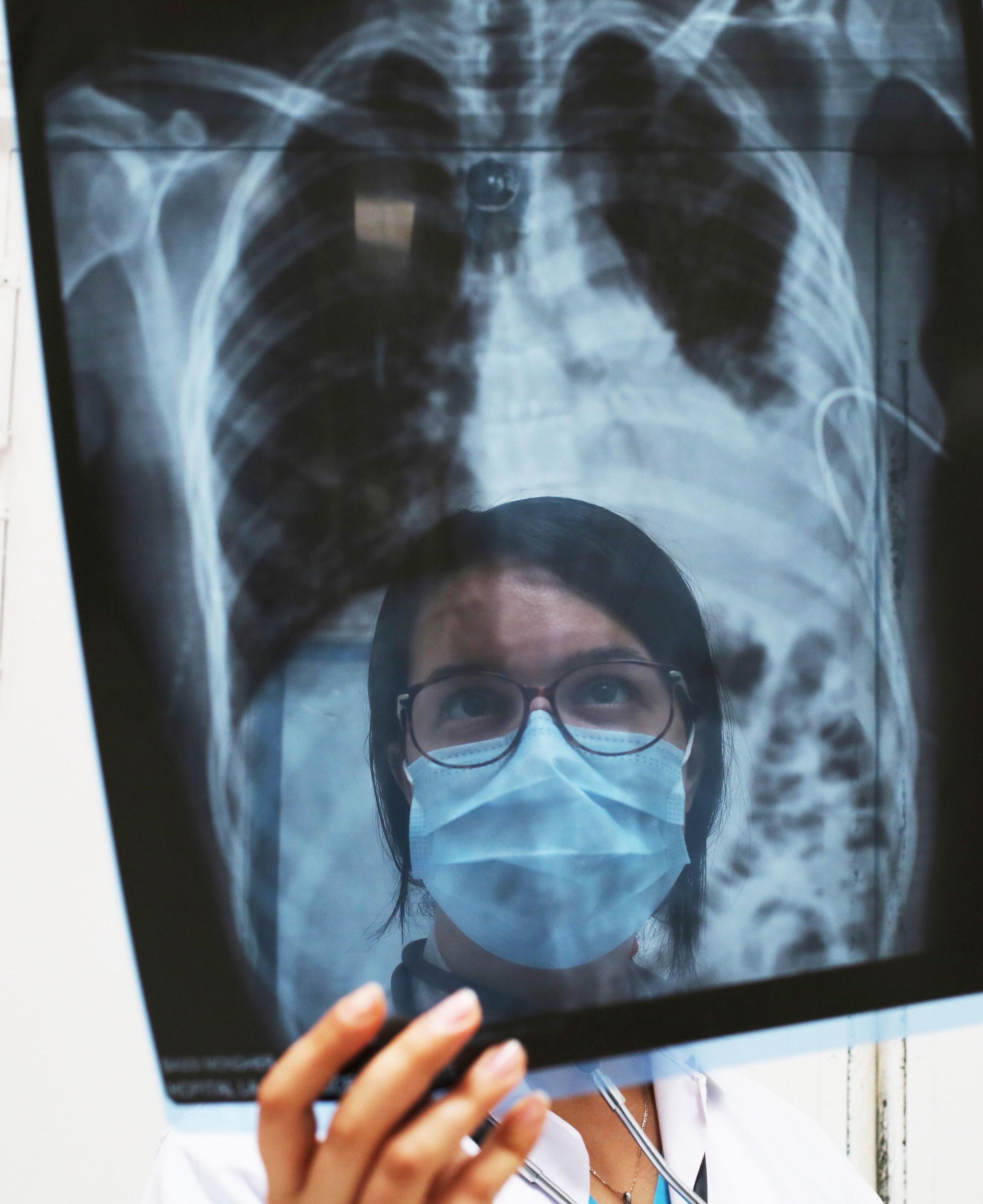 Două simptome noi COVID-19 sunt, de fapt, primele semne ale bolii! Medicii, &icirc;n alertă: &bdquo;Evoluția nu va fi favorabilă&rdquo;