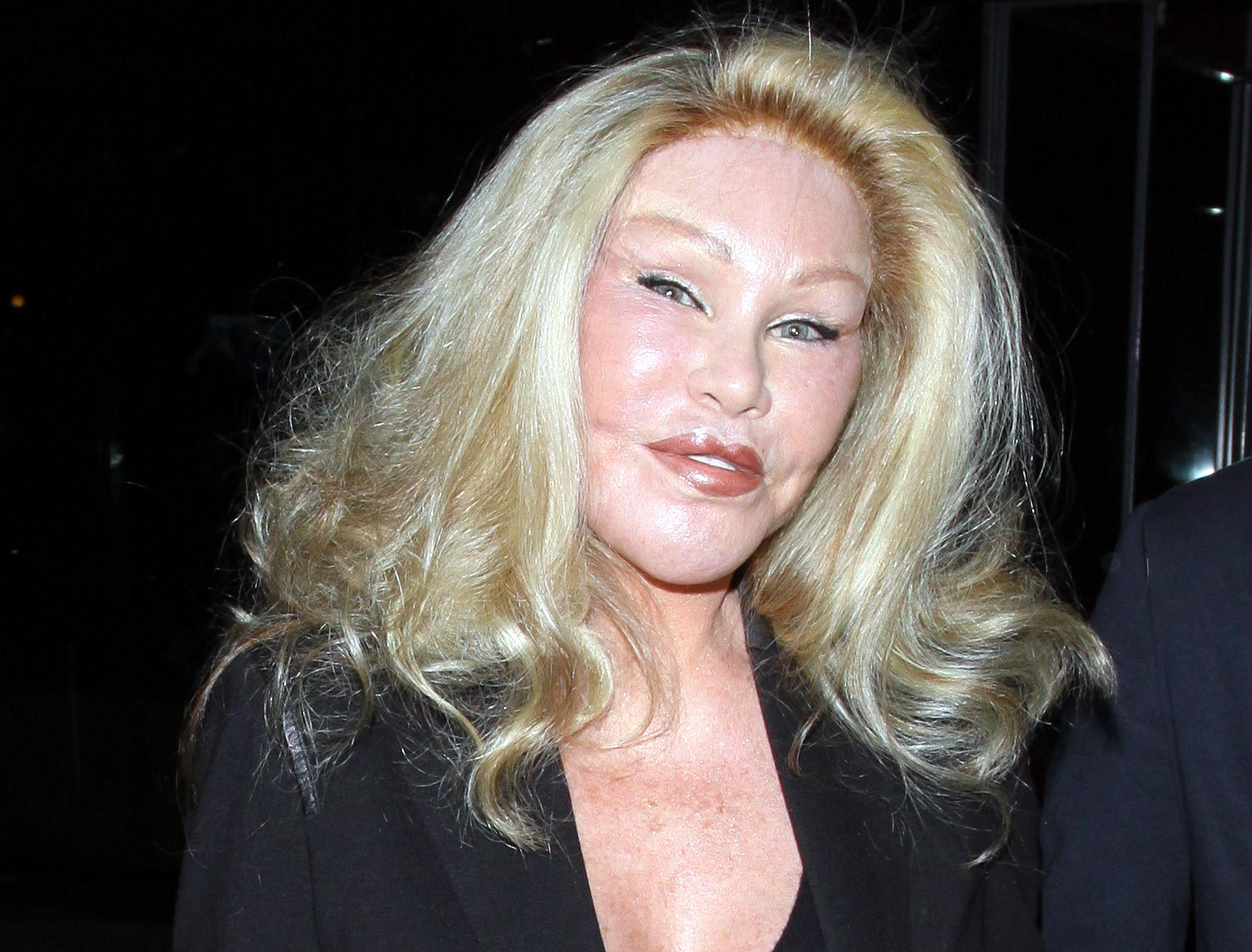 Operațiile estetice i-au transformat fața &icirc;n cea a unui animal. Drama prin care trece &ldquo;Femeia-Pisică&rdquo; Jocelyn Wildenstein