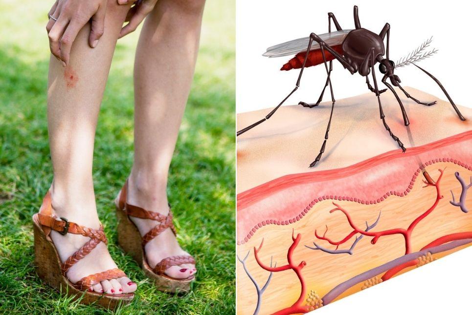 Ce se întâmplă în corpul nostru când ne mușcă un țânțar. Efectele pe care le poate avea o banală ciupitură