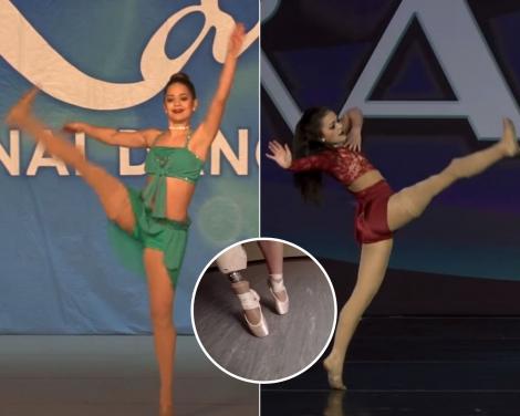 Povestea micuței dansatoare care cucerește marile scene cu doar un picior. Cât de schimbată e la 10 ani după ce a învins cancerul