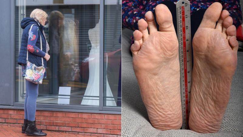 colaj de imagini cu picioarele juliei felton, femeia cu cele mai lungi talpi din lume