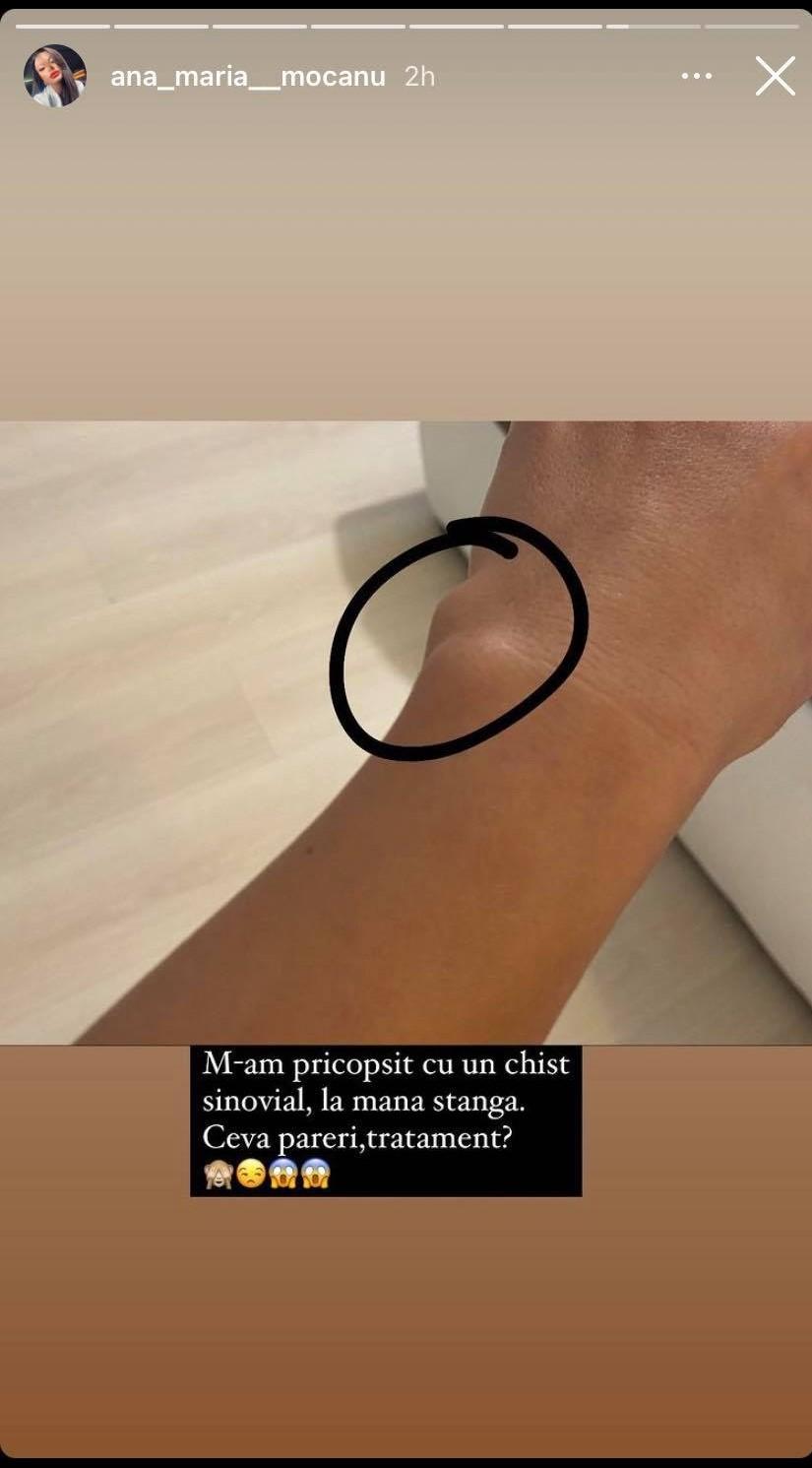 Mana Anei Mocanu, pe care i-a apărut un chist