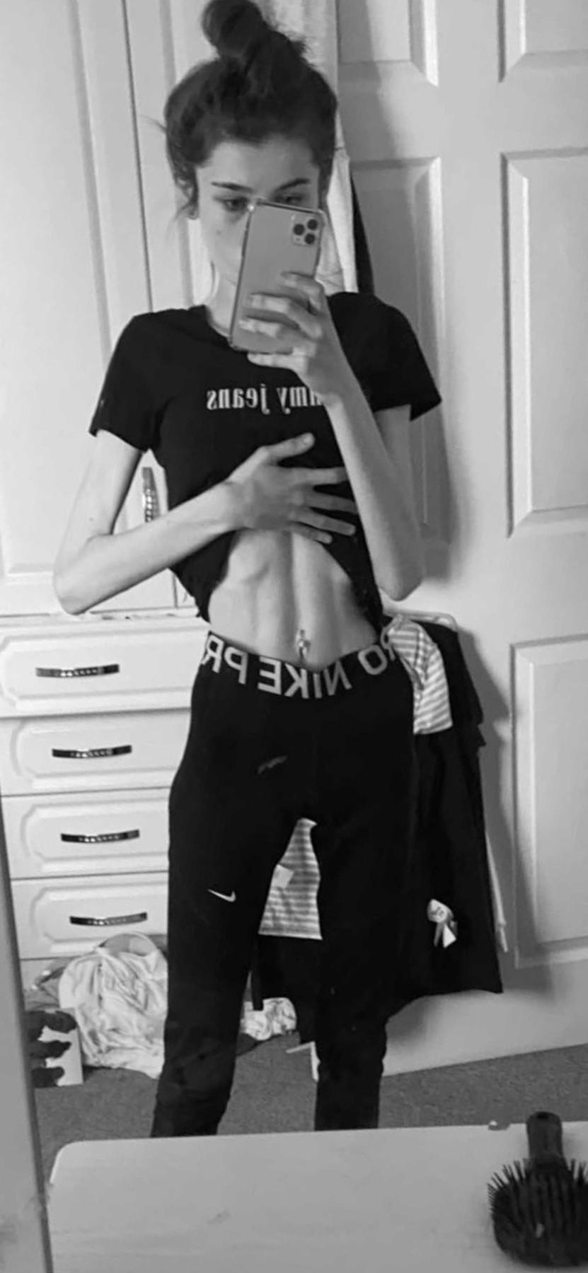 Ellie Makin, făcându-și selfie la abdomen, pe vremea când avea anorexie