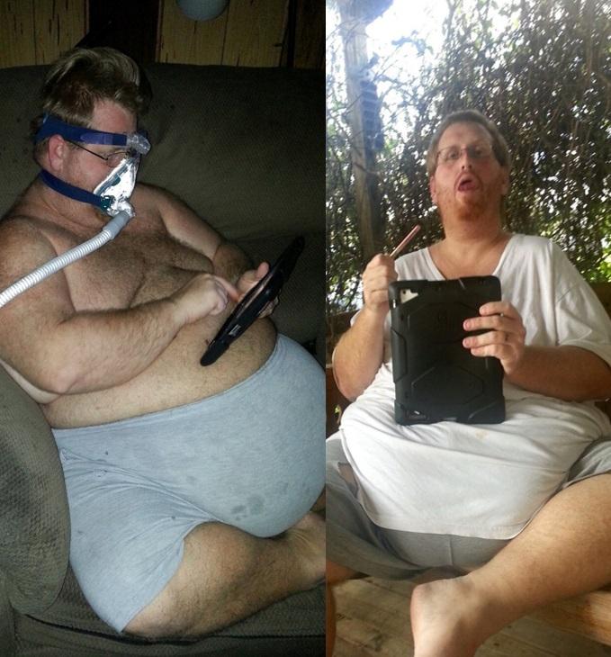 Zach Moore pe vremea când avea 226 kilograme, stând în haine de casă pe fotoliu, cu un aparat de oxigen la nas (stanga) sau stând pe banca in curtea casei, cu tableta in maini (dreapta)