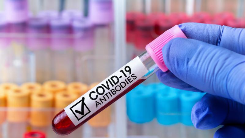 test-anticorpi-coronavirus