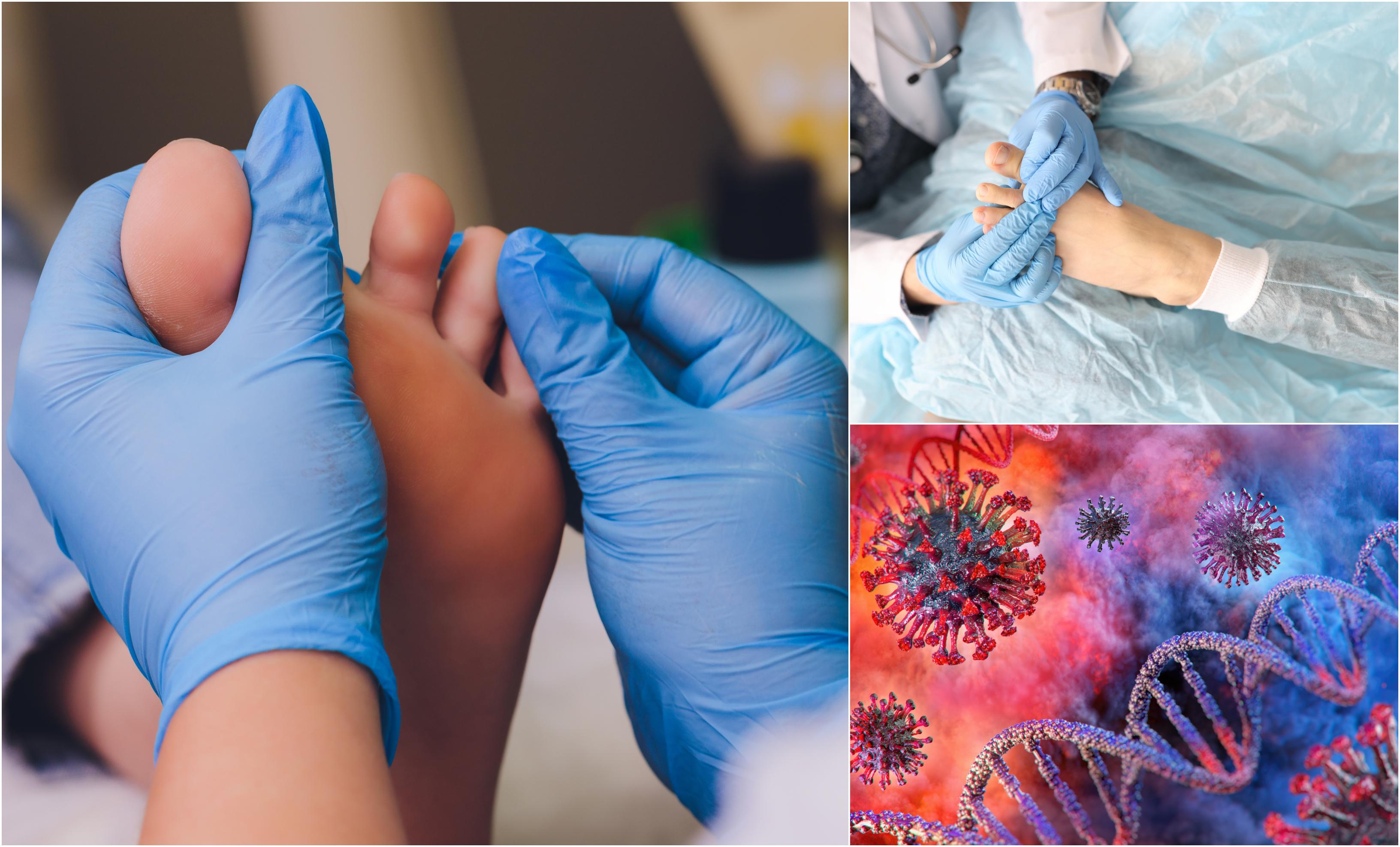 colaj de fotografii cu picioarele unor persoane și imaginea plastică a virusului covid-19