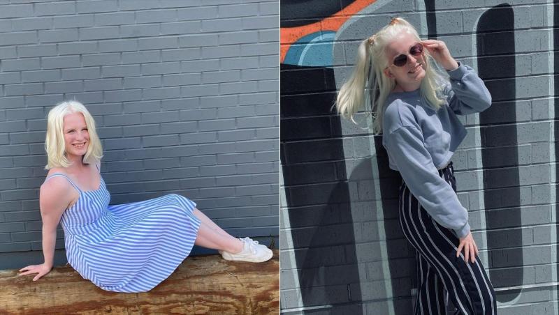Mackenzie Strong, o tânără în vârstă de 19 ani, este albinoasă, iar fotografiile cu ea au făcut înconjurul internetului datorită înfățișării sale ieșite din comun.