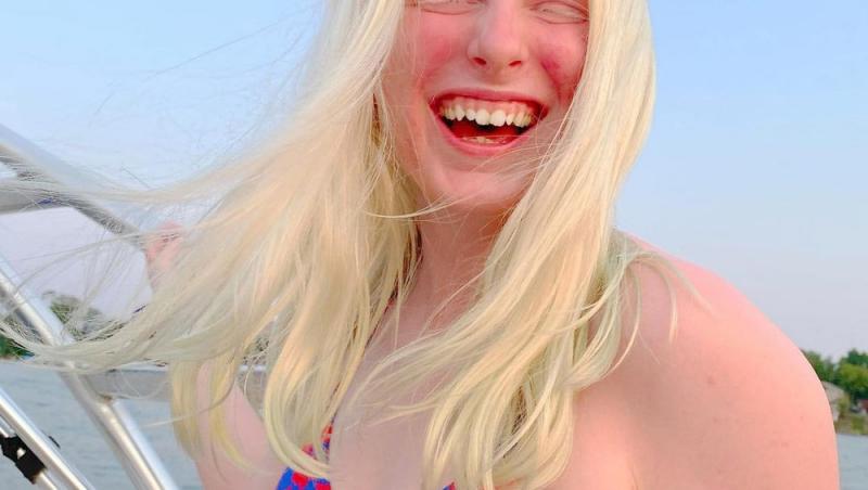 Mackenzie Strong, femeia albinoasă cu ochii violet, a uimit o lume întreagă. Toți cred că e un personaj de film