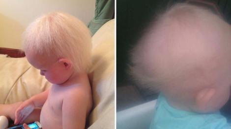 Băiețelul care suferă de sindromul "părului de nepieptănat". Cum arată acum și ce au spus medicii când l-au văzut