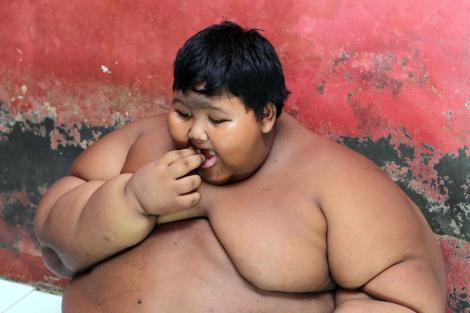 Cum arată azi Arya Permana, poreclit „cel mai gras copil din lume”, după ce a slăbit 110 kilograme