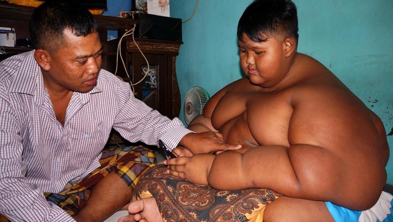 Azi, Arya Permana, cel care era supranumit „cel mai gras băiat din lume”, are o greutate normală