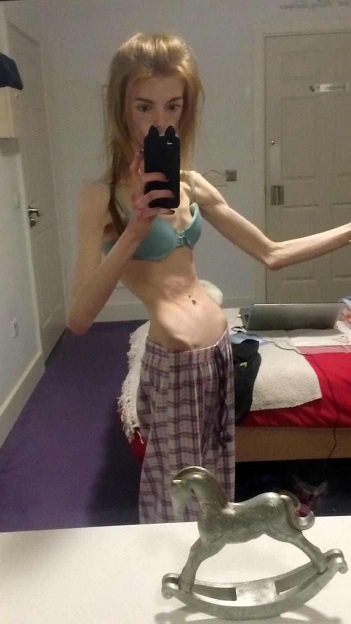 Annie Windley, selfie în oglindă pe când avea o greutate de 28 de kilograme