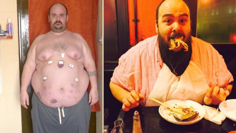 Jonny Bonello a început să consume din ce în ce mai multe alimente, adică până la 6000 de calorii, iar stomacul i s-a lărgit în mod inevitabil.