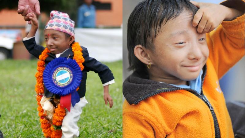 Khagendra Thapa Magar este cel mai mic om din lume