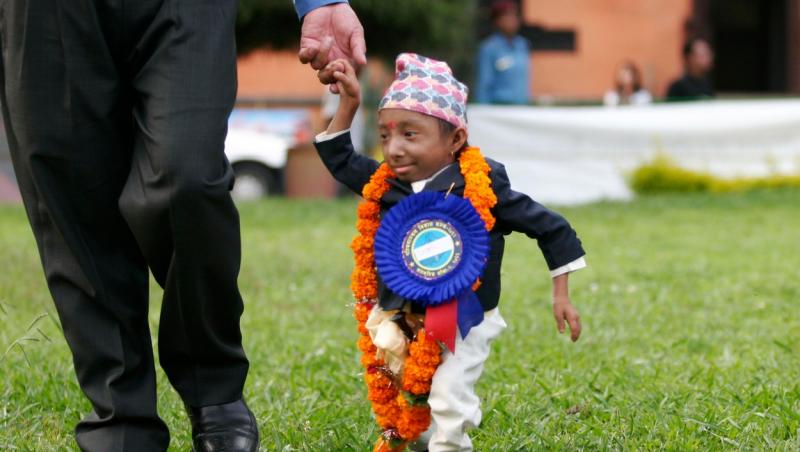 Khagendra Thapa Magar este cel mai mic om din lume și s-a stins din viață din cauza unei boli grele. Câți ani avea când a murit