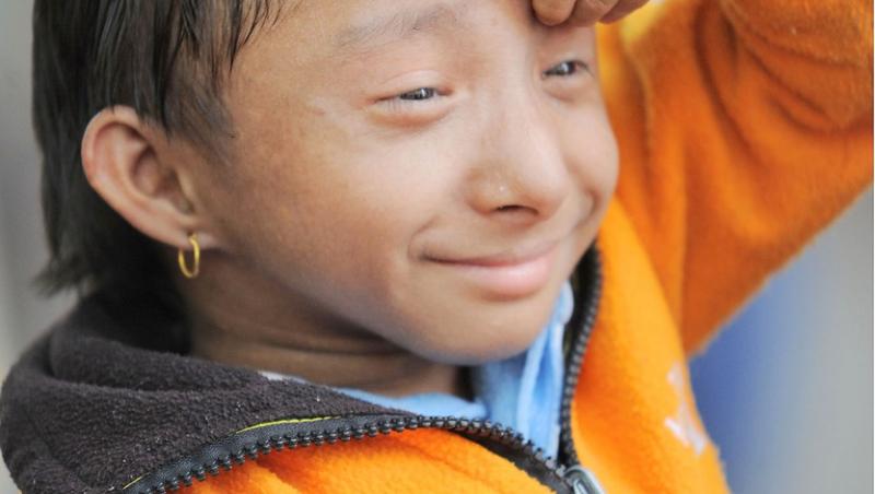 Khagendra Thapa Magar este cel mai mic om din lume și s-a stins din viață din cauza unei boli grele. Câți ani avea când a murit