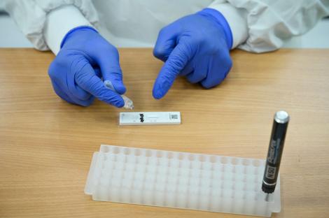Medicii de familie vor avea teste antigen rapide, pentru a creşte capacitatea de testare. De când vor fi disponibile în cabinete