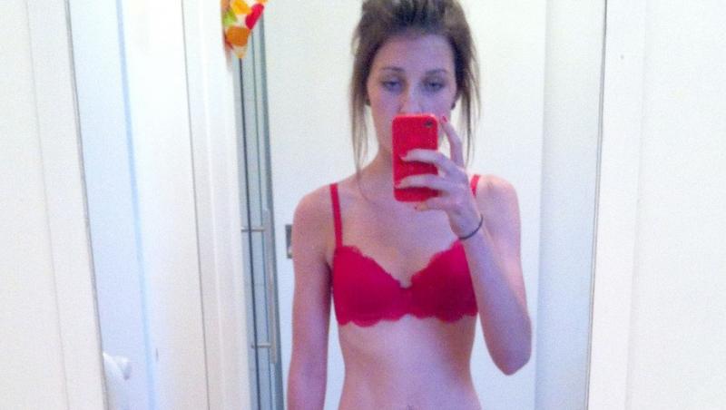 Chloe White a ajuns să cântărească doar 31 de kilograme din cauza anorexiei