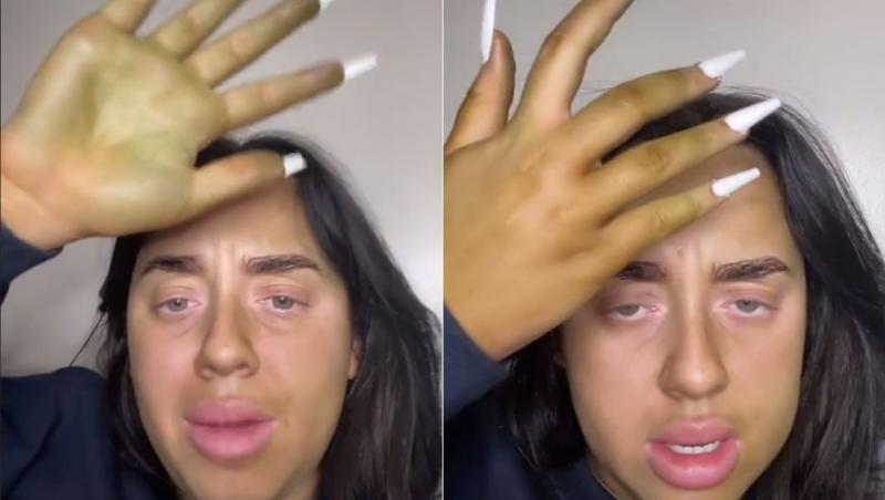 O femeie susține că pielea i s-a înverzit pielea după ce a vrut să se bronzeze artificial