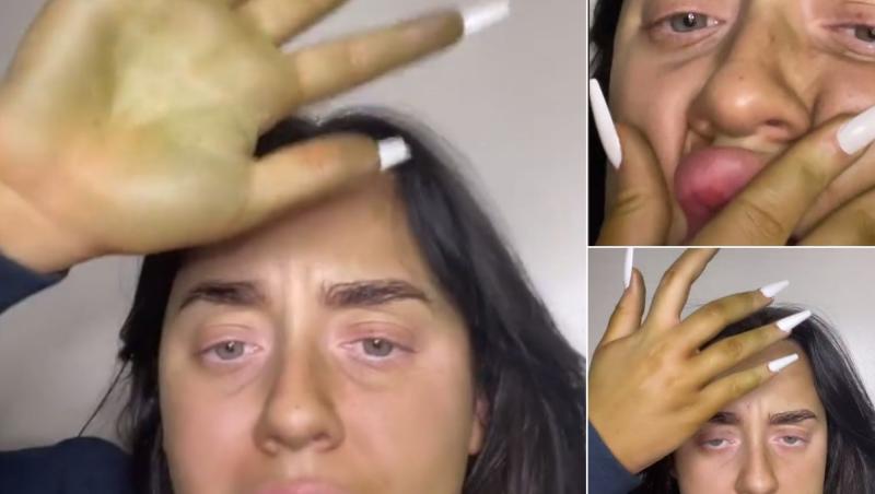 O femeie susține că pielea i s-a înverzit pielea după ce a vrut să se bronzeze artificial