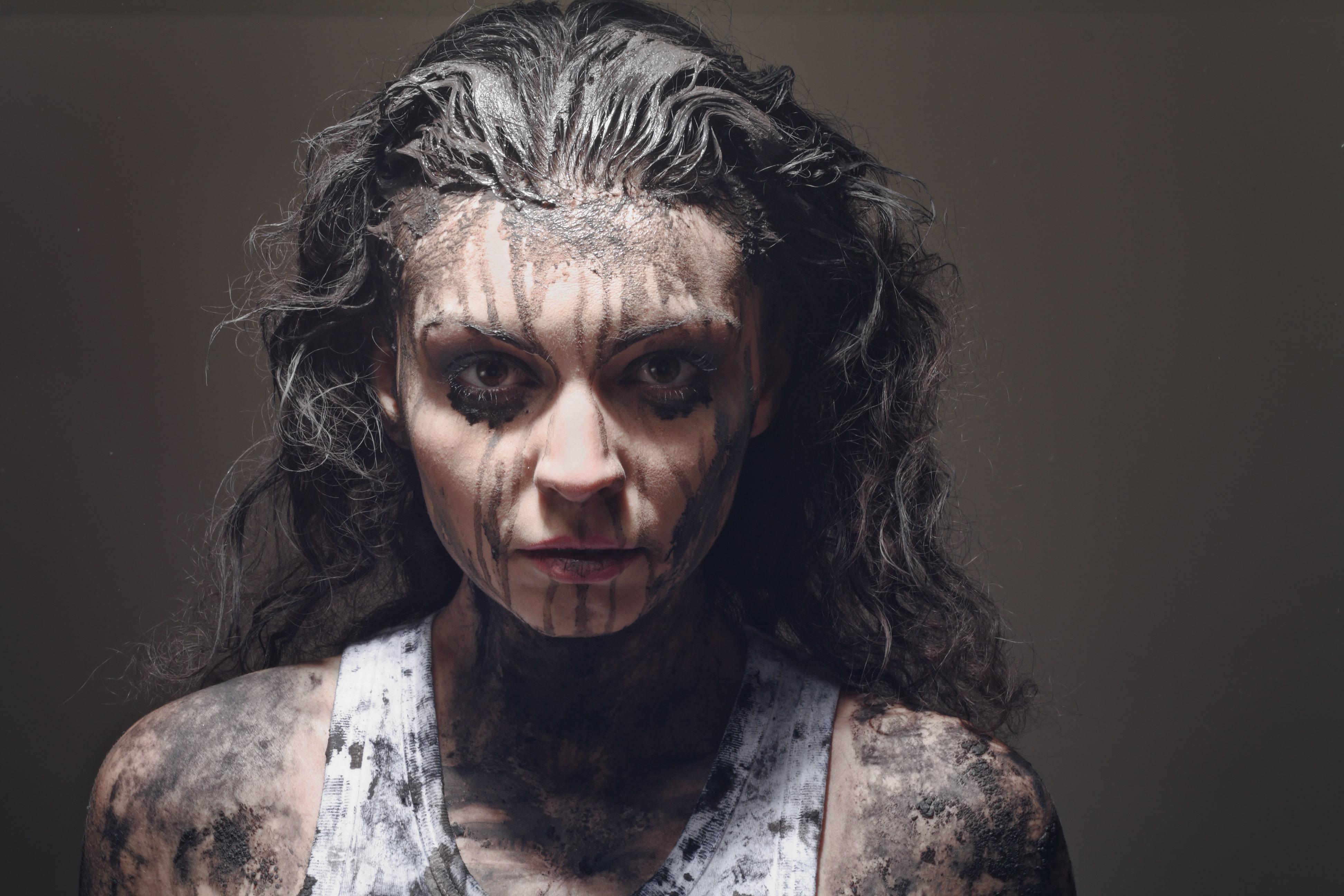 La 23 de ani, o t&acirc;nără se transformă &icirc;ncet &icirc;n piatră. Cum e posibilă transformarea și ce o cauzează