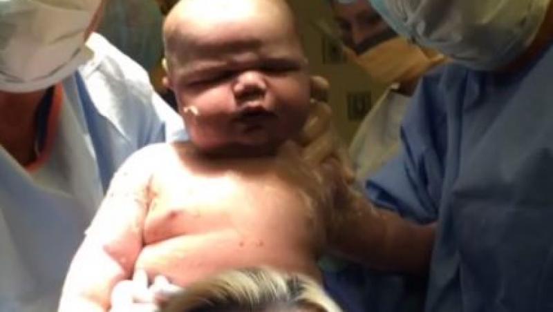 Nou-născutul i-a luat prin surprindere atât pe părinți cât și pe medicii care nu se așteptau să cântărească aproape 7 kilograme la naștere