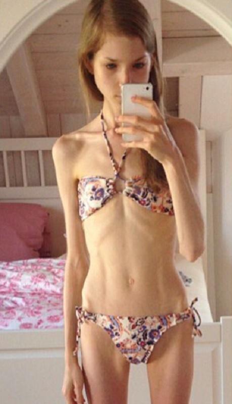 Chiara Schober , selfie in oglinda, pe vremea cand era anorexica