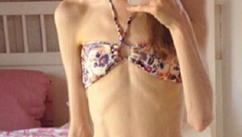 Chiara Schober , selfie in oglinda, pe vremea cand era anorexica